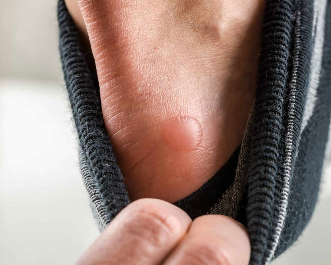 The Science and Innovation Behind Grypto's Blister-Proof Socks